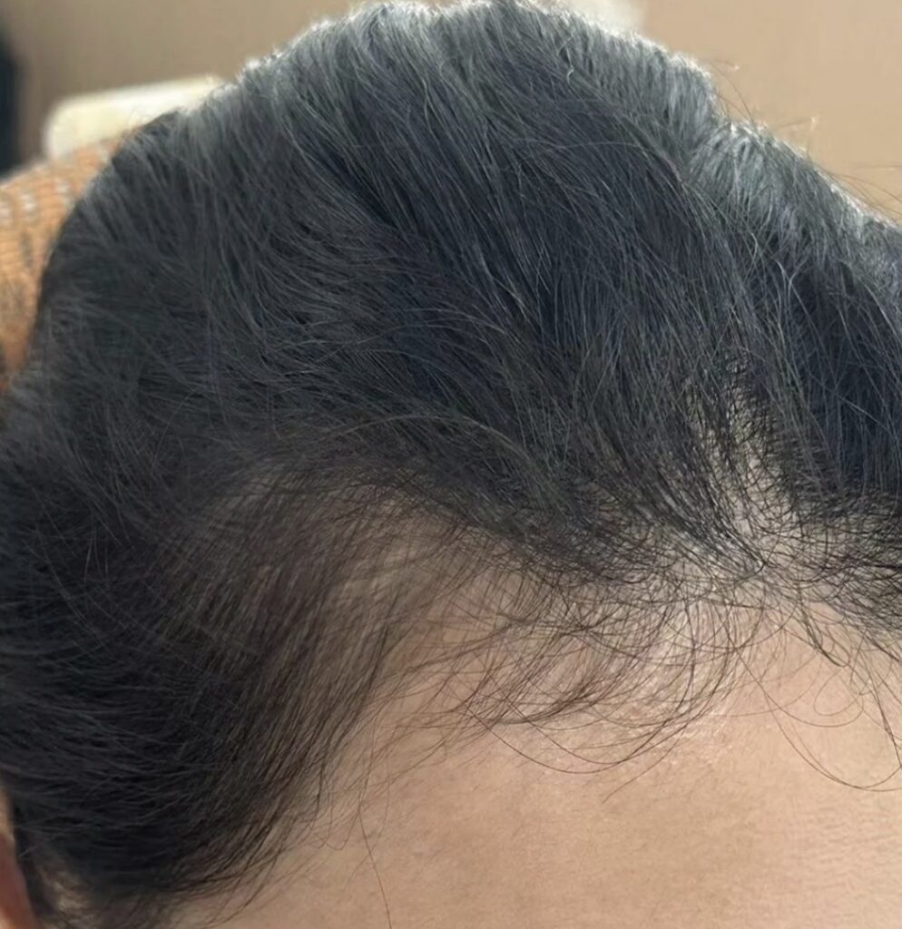 After